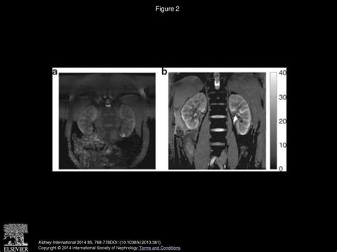 New Magnetic Resonance Imaging Methods In Nephrology Ppt Download