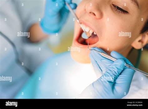 Little boy with open mouth in a dental cabinet, pediatric dentistry ...