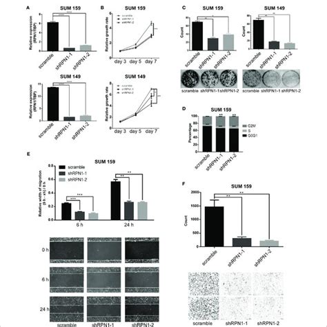 Rpn1 Knockdown Inhibited The Growth And Invasion Of Blbc Cells A Download Scientific