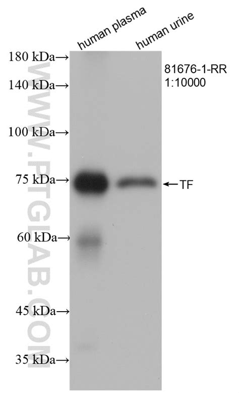 Transferrin Antibody Rr Proteintech