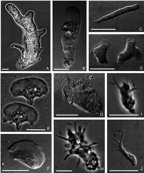 Representatives Of The Major Phylogenetic Lineages Of Naked Amoebae A