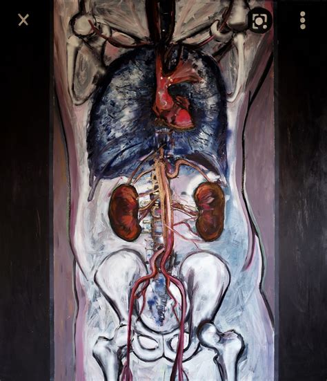 Body CT, 2022. - Art Pécs