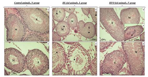 Morphological Analysis Morphological Alterations Of Seminiferous