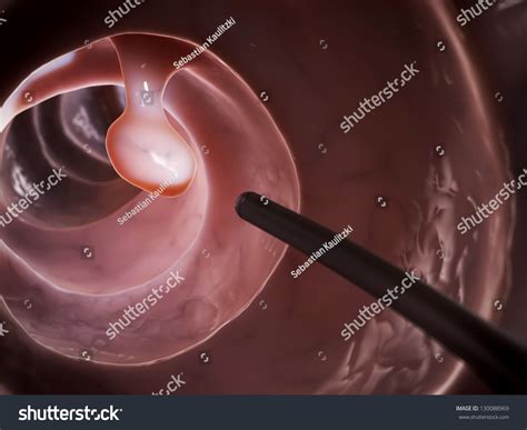 3d Rendered Illustration Colonoscopy Stock Illustration 130088969