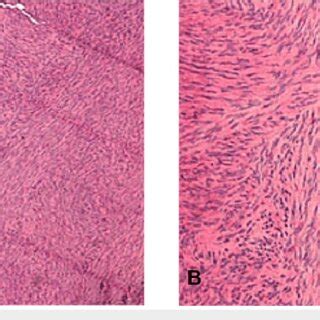 H E Stained Section A H E Stained Section At Magnification Shows