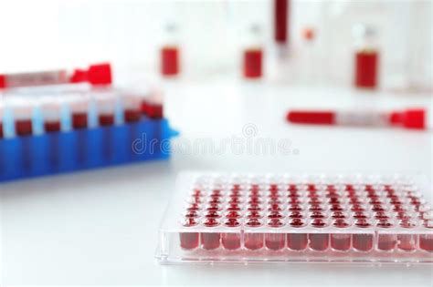 Test Tubes With Blood Samples In Holder On Table Stock Photo Image Of