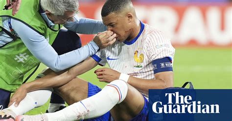 Kylian Mbappé Podría Perderse El Resto De La Fase De Grupos De La Eurocopa 2024 Por Fractura De