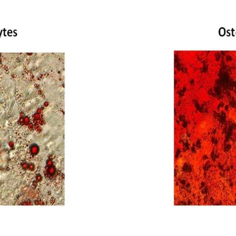 Characterization Of Human Umbilical Cord Vein Derived Mesenchymal Stem