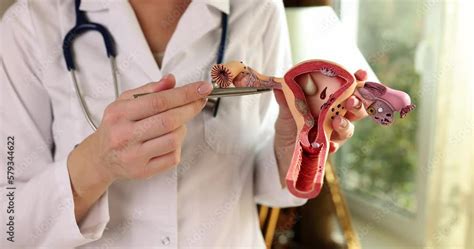 Gynecologist Shows Structure Of Uterus On Model Of Uterus Stock Video