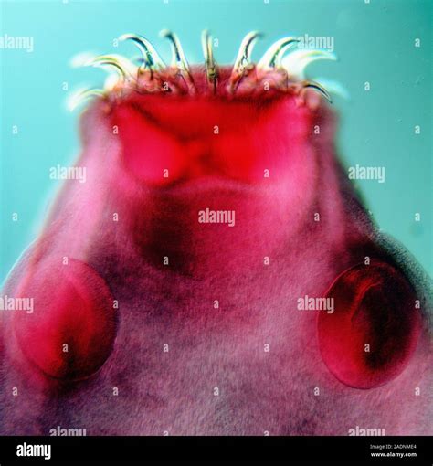 Tapeworm Head Light Micrograph Of The Scolex Head Of The Adult Pork Tapeworm Taenia Solium