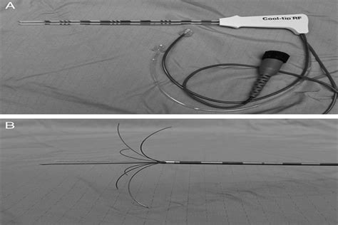 How I Do It Radiofrequency Ablation And Cryoablation Of Lun