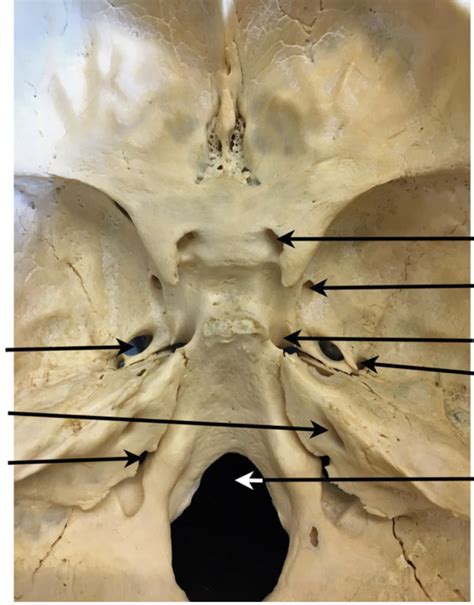 SKULL SUPERIOR FORAMINA Diagram Quizlet