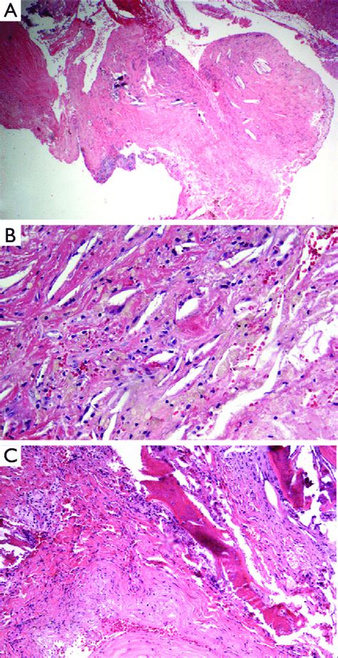 Histologic Examination Hematoxylin And Eosin Stain A 5× B 20× C