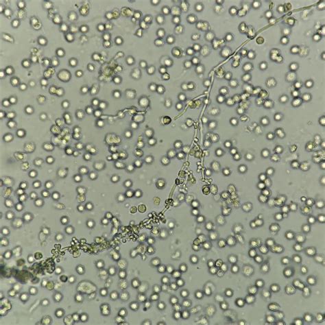 Yeast Budding And Hyphae Medlabbuddy