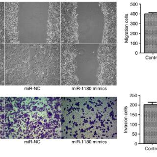 Mir Inhibits The Migration And Invasion Of Du Cells A Wound