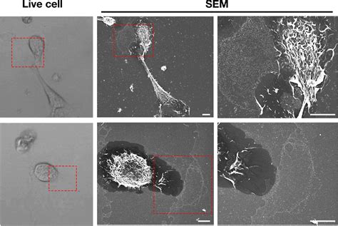 Release Of Cholesterol Rich Particles From The Macrophage Plasma