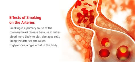 How Smoking Affects Your Heart Modern Heart And Vascular