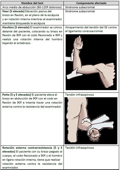 El Hombro Doloroso Cl Nica Reumatol Gica Doctor Ponce