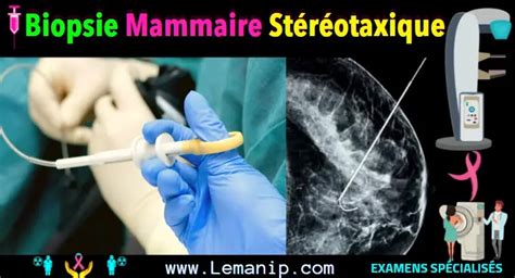 Biopsie Mammaire St R Otaxique Radiologie Sp Cialis S