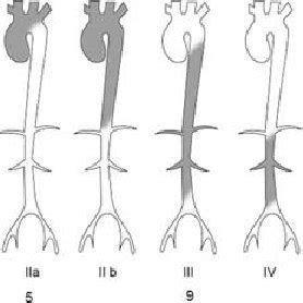 Angiographic classification of arterial lesions in 76 patients with... | Download Scientific Diagram