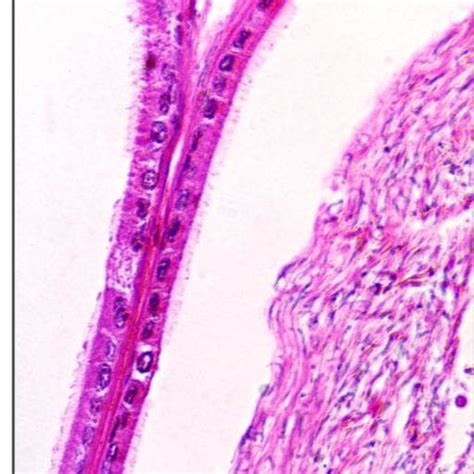 Photomicrograph Of The Cross Section Of Cauda Epididymis Of Aluminium