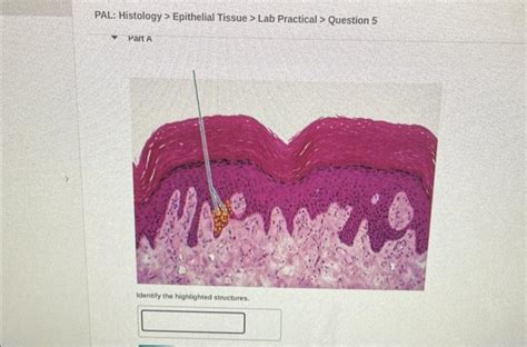 Solved PAL Histology Epithelial Tissue Lab Practical Chegg