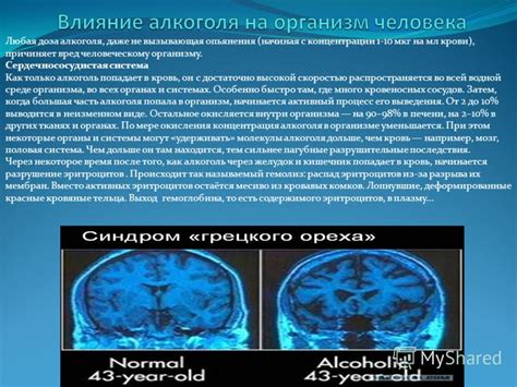 Презентация на тему: "Любая доза алкоголя, даже не вызывающая опьянения ...