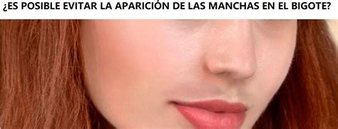 C Mo Prevenir Las Manchas Faciales Este Verano