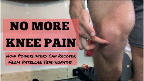 Patellar Tendinopathy Rehab For Powerlifters YouTube