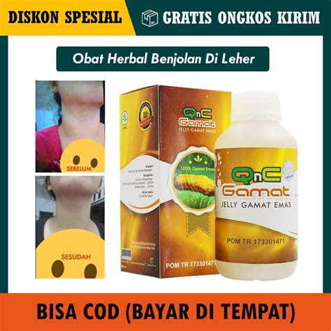 Jual Obat Kelenjar Getah Bening Kelenjar Tiroid Benjolan Di Leher