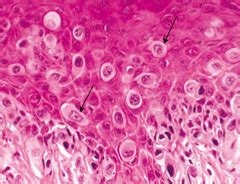 FCM Female Repro Path Cervix And Vagina Flashcards Quizlet