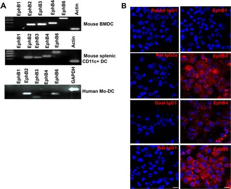 DCs Express Eph Receptors Other Than EphB2 RNA Was Extracted From