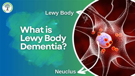 What Is Lewy Body Dementia Symptoms And Treatment Options Voise