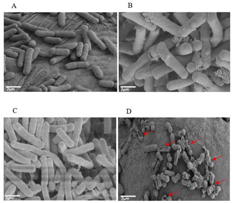 Colistin And Tetrandrine In Combination Causes Membrane Damage And