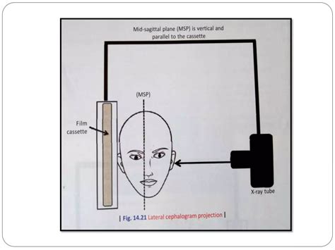 Extra-oral Radiographic Techniques | PPTX