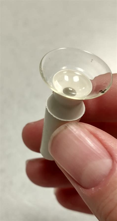 Scleral Lens Insertion And Removal Tips Eyecare Associates Of Lees