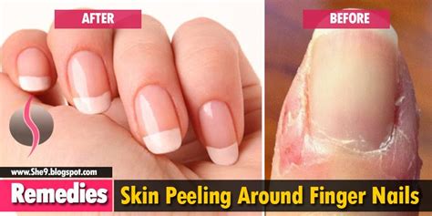 How To Remove Nails Cuticles Howtoremvo