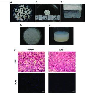 Production Of The Decellularized Cartilage Extracellular Matrix A