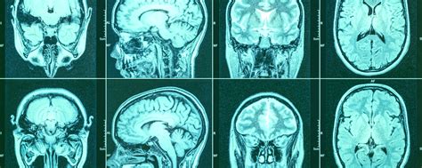Нейрофизиология | Группа http://vk.com/neurophysiology посвящена ...
