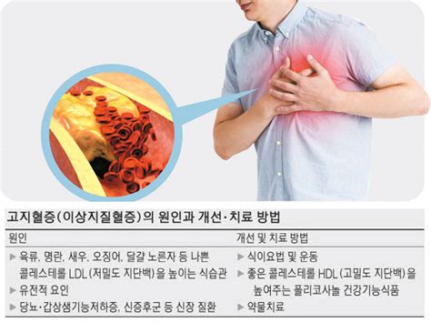 Health 고지혈증 치료 `좋은 콜레스테롤`에 달렸죠 매일경제