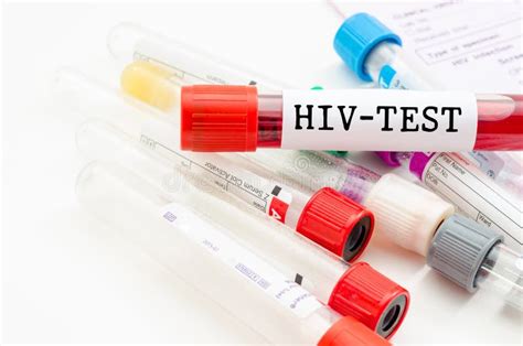 Sample Blood Collection Tube With Hiv Test Stock Photo Image Of Aids