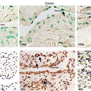 Photomicrographs (original magnification, 3 100 [top row] and 3 40 ... 