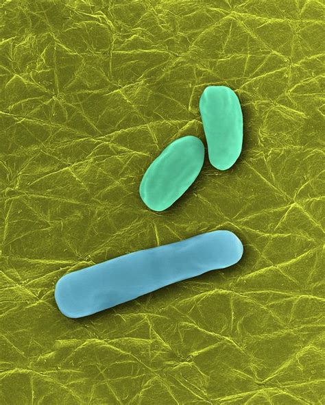 Bacillus Anthracis Photograph By Dennis Kunkel Microscopy Science Photo