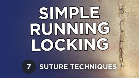 Continuous Locking Stitch