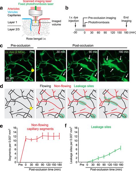 Induction Of Capillary Ischemia During Two Photon Imaging A Schematic