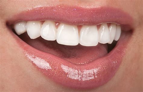 What To Look For In A Great Teeth Whitening Treatment