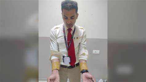 Gold Mining Scam 1 Kg Gold Wrapped Around Wrist Air India Cabin Crew