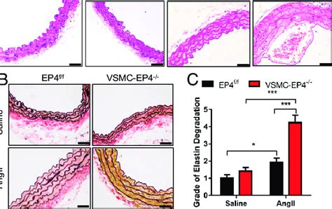 Vsmc Ep Deficiency Causes Aortic Elastin Fiber Degradation In Mice Wt