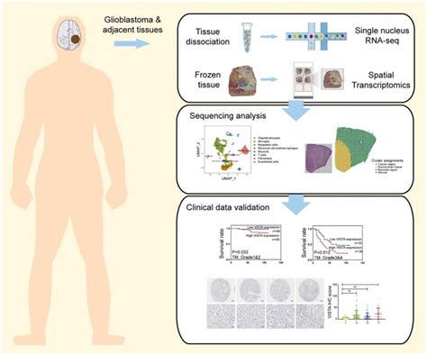 Co Expression Of Immune Checkpoints In Glioblastoma Revealed By Single