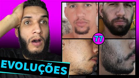 EVOLUÇÃO DOS INSCRITOS MINOXIDIL 77 YouTube